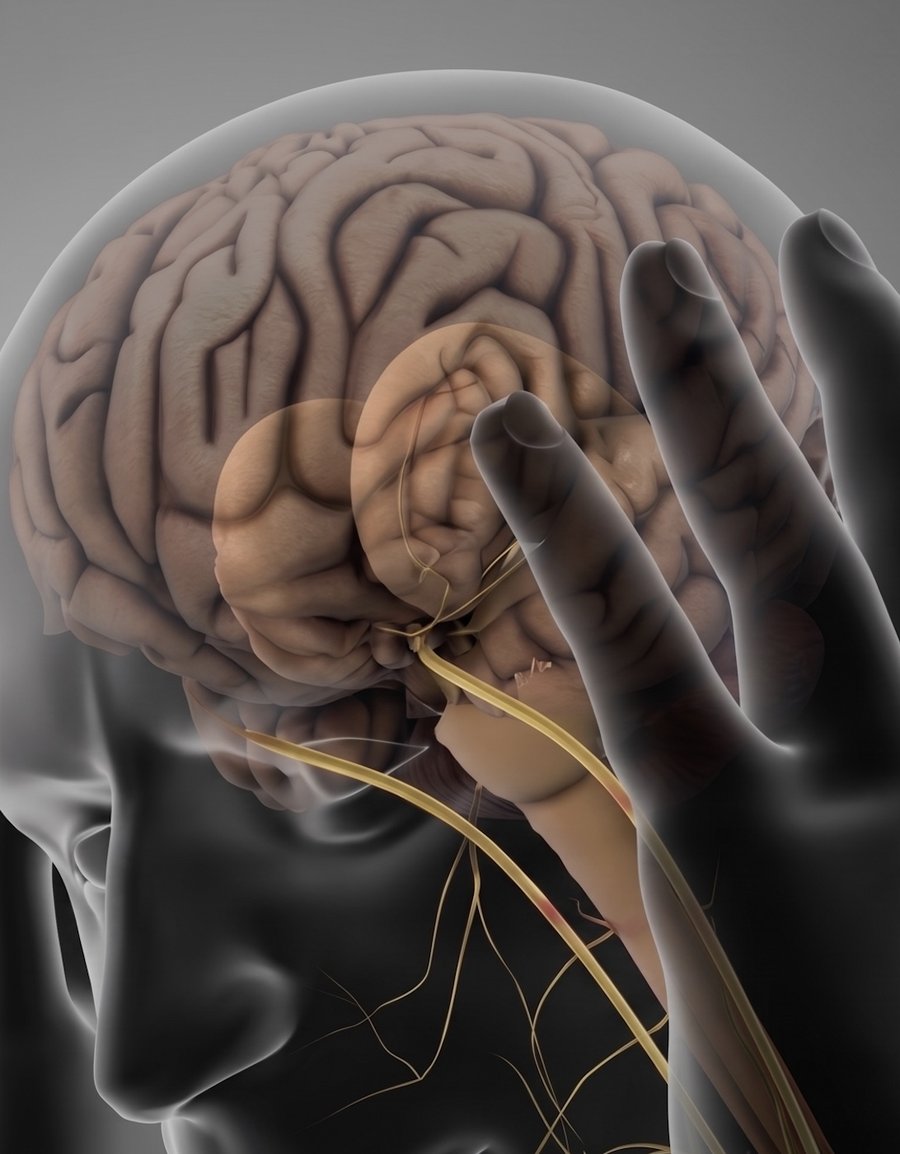 Visualisation médicale du brouillard cérébral