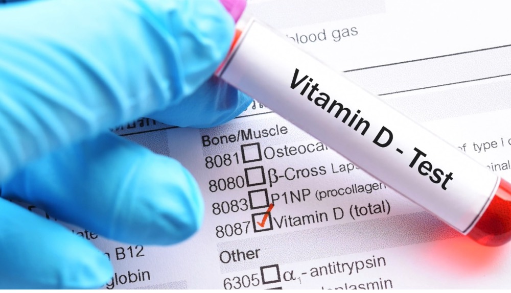 Blood sample vial labelled Vitamin D Test