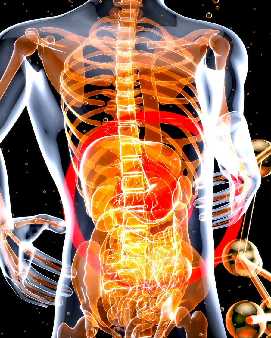 Visualisation médicale d'un intestin enflammé